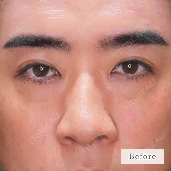 CLEAN BEAUTY CLINIC TokyoAzabu 三田 亜耶医師の症例