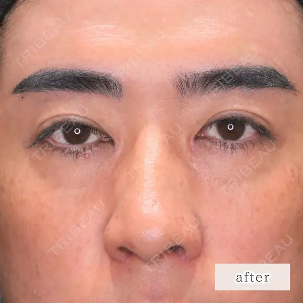 CLEAN BEAUTY CLINIC TokyoAzabu 三田 亜耶医師の症例