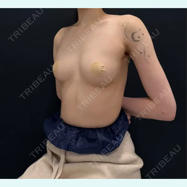 First Clinic 岩崎 浩亮医師の症例
