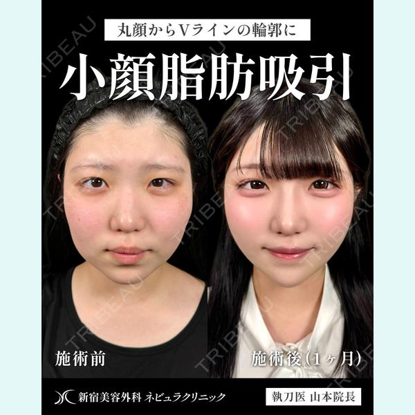 新宿美容外科ネビュラクリニック 山本 紘子医師の症例