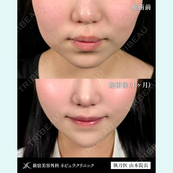 新宿美容外科ネビュラクリニック 山本 紘子医師の症例