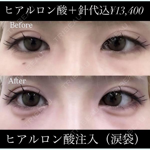 東京美容皮膚科アロエクリニック池袋西口院の症例