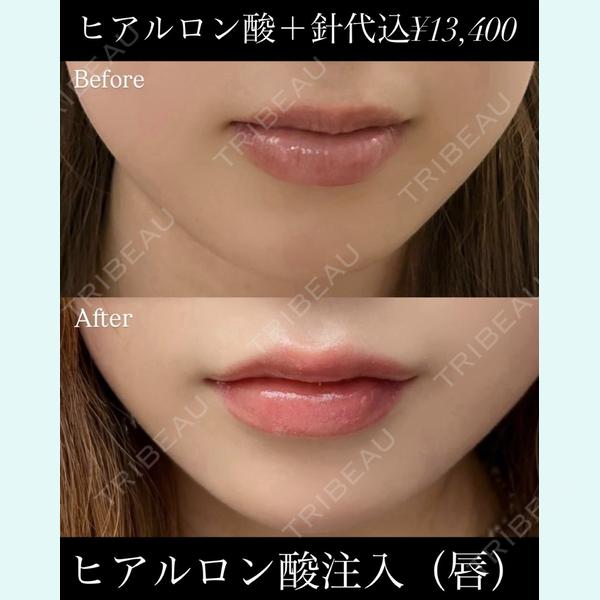 東京美容皮膚科アロエクリニック池袋西口院の症例