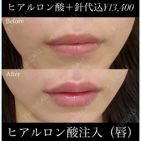 東京美容皮膚科アロエクリニック池袋西口院の症例