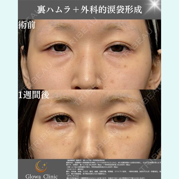 Glowa Clinic 岡村　尚泰医師の症例