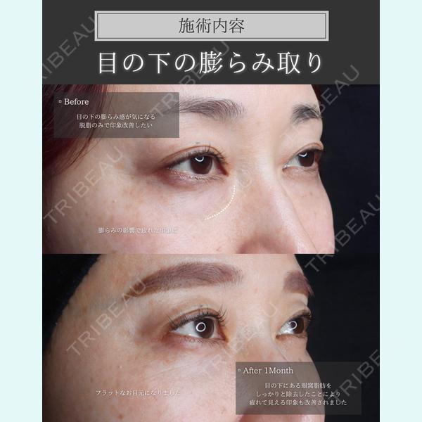 Shea clinic sendai 青木 智之医師の症例