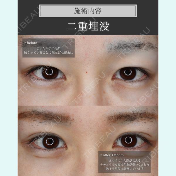Shea clinic sendai 青木 智之医師の症例