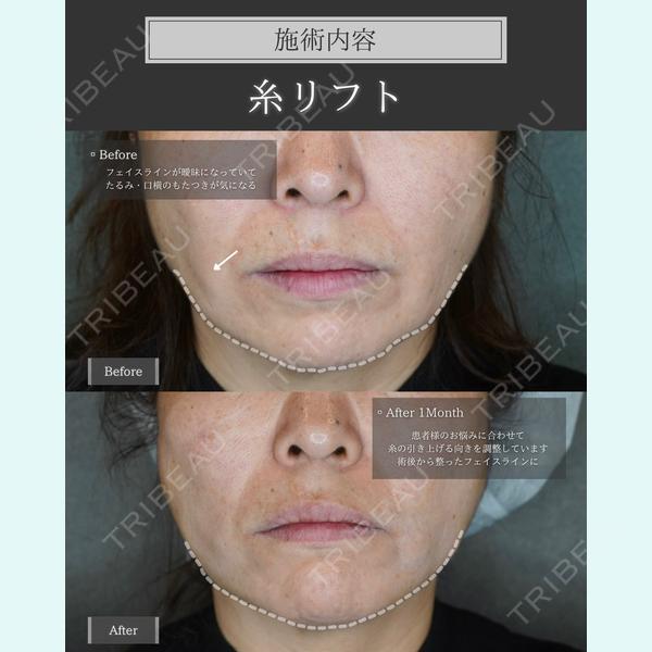 Shea clinic sendai 青木 智之医師の症例