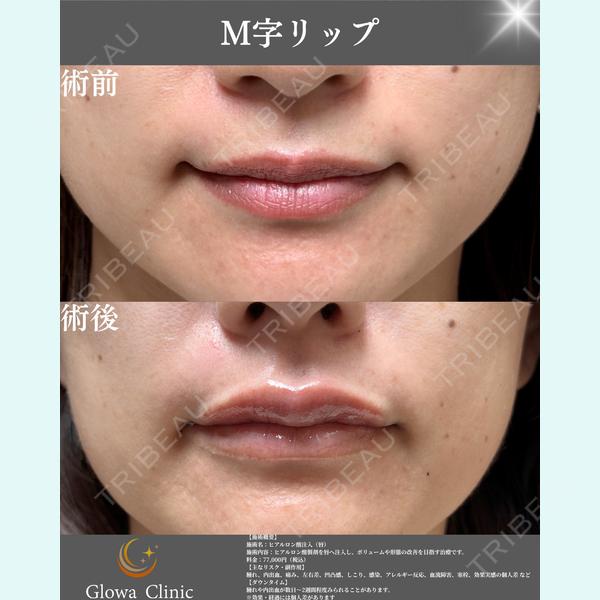 Glowa Clinic 岡村　尚泰医師の症例