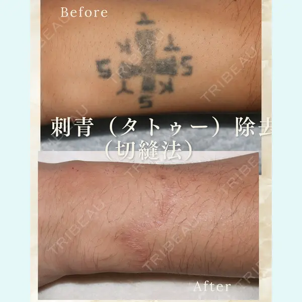 青森タウン形成外科クリニックの症例