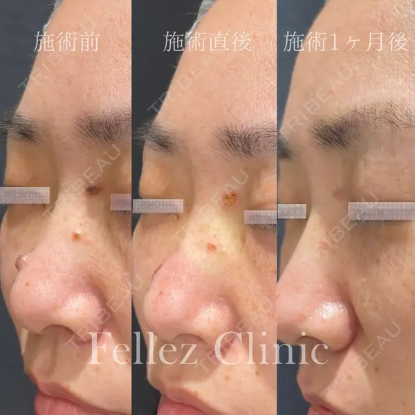 Fellez Clinic【フェルズクリニック】 小野 泰寛医師の症例