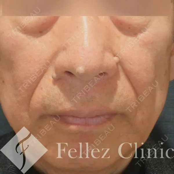 Fellez Clinic【フェルズクリニック】 小野 泰寛医師の症例