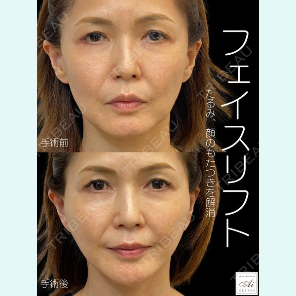 SHINSAIBASHI Ai CLINICの症例