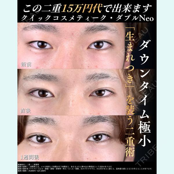 湘南美容クリニック 静岡南口院 大須 直人医師の症例