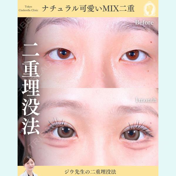 東京シンデレラ美容外科 新宿院 金智優医師の症例