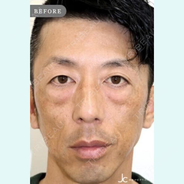 自由が丘クリニック 兵頭徹也医師の症例