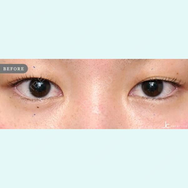 自由が丘クリニックソフィアの症例