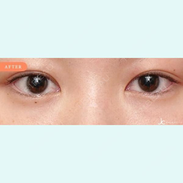 自由が丘クリニックソフィアの症例