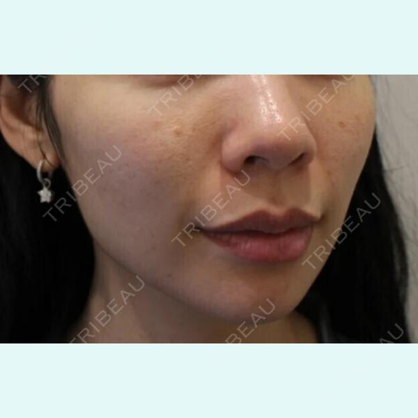 フォレナクリニック(Forena Clinic) ホンデ店の症例