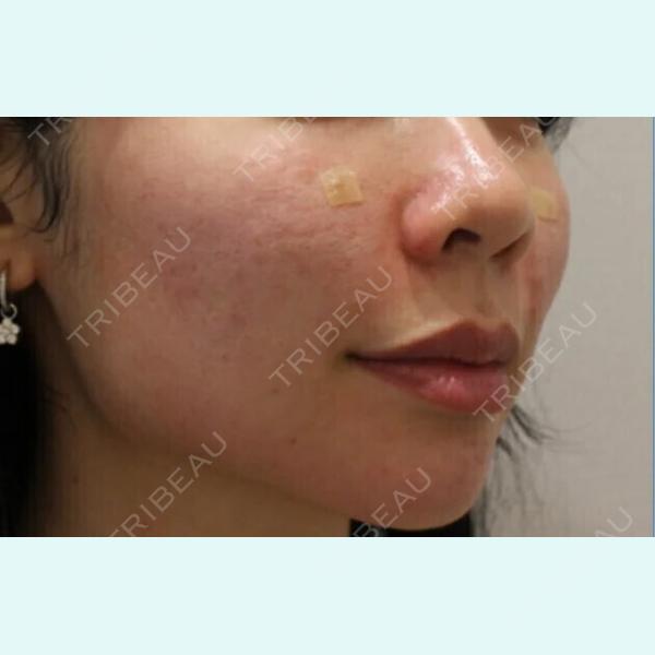 フォレナクリニック(Forena Clinic) ホンデ店の症例