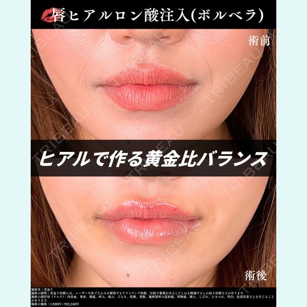 湘南美容クリニック 静岡南口院の症例