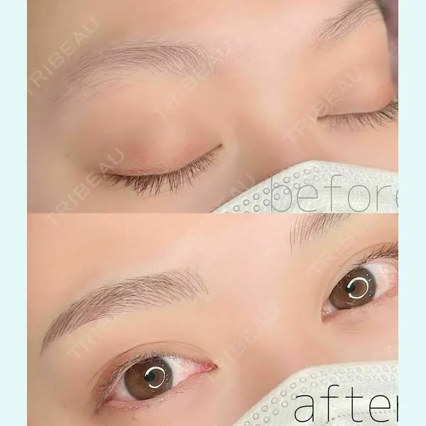 LEAGRANT CLINIC 中目黒 谷上 奈緒子医師の症例