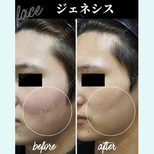SHINSAIBASHI Ai CLINICの症例