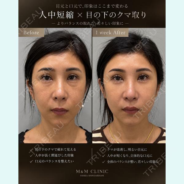 M&M クリニック 加藤　葵子医師の症例