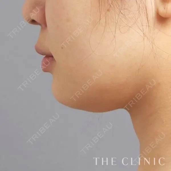 THE CLINIC（ザ・クリニック） 名古屋院の症例