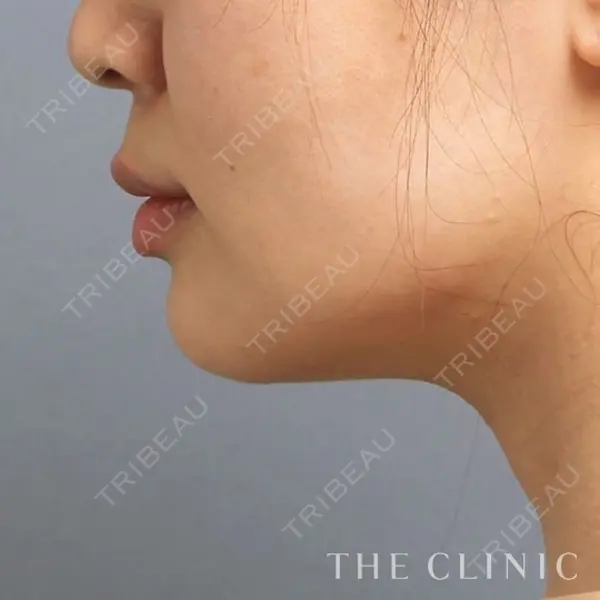THE CLINIC（ザ・クリニック） 名古屋院の症例