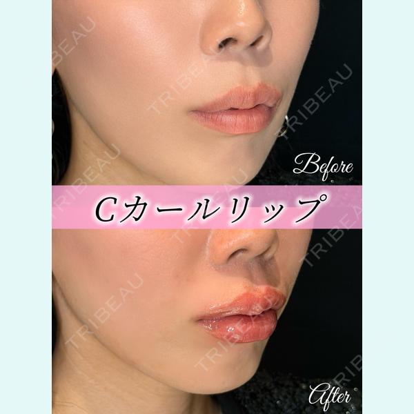 ルラライト美容クリニック 八王子院 桑野 淳医師の症例