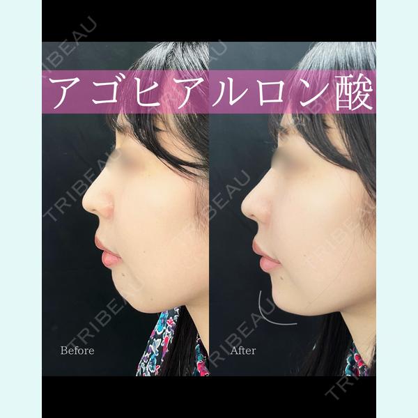 ルラライト美容クリニック 八王子院 桑野 淳医師の症例