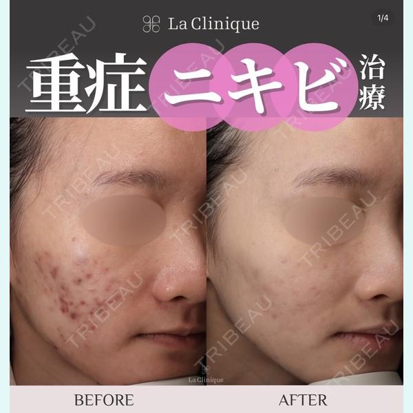 La Clinique Osaka 【ラクリニック大阪】の症例