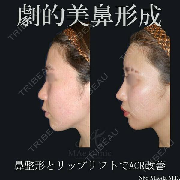 MAe Clinic 東京院 前田 翔医師の症例
