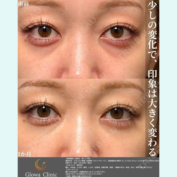 Glowa Clinicの症例