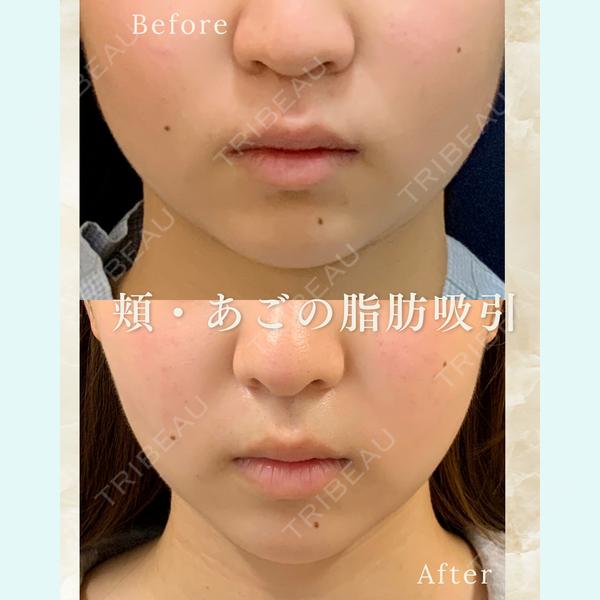 郡山タウン形成外科クリニック 石原 信浩医師の症例