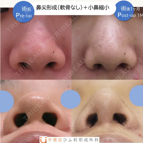 宇都宮ひふ科形成外科 宇都宮 裕己医師の症例