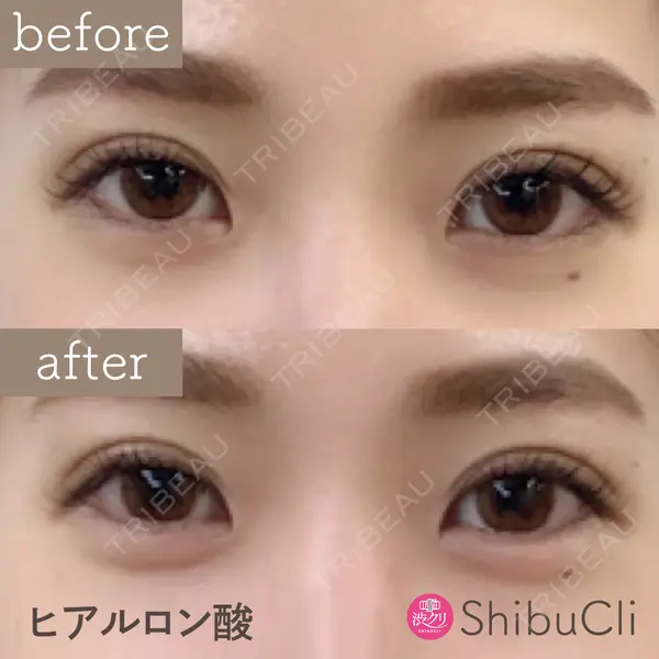 渋谷美容外科クリニック 新宿院 野口 なつ美医師の症例