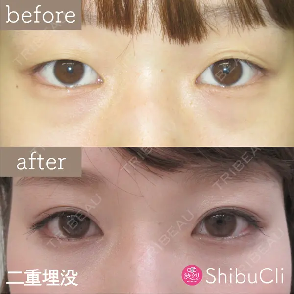 渋谷美容外科クリニック 池袋院の症例