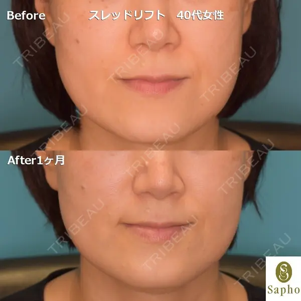 サフォクリニック 白壁 聖亜医師の症例