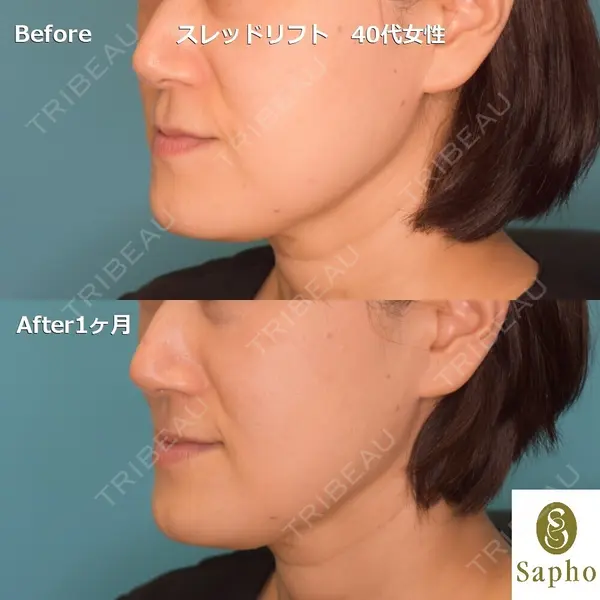 サフォクリニック 白壁 聖亜医師の症例