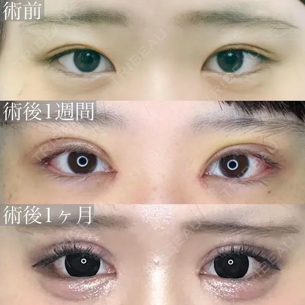 渋谷の森クリニック 森 克哉医師の症例