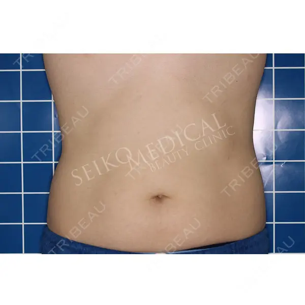 セイコメディカルビューティクリニック 福岡院 曽山　浩輔医師の症例