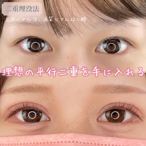 ルラ美容クリニック 大阪本院の症例