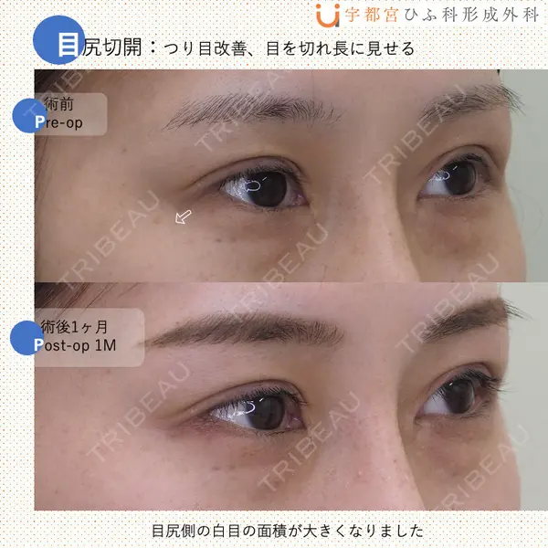宇都宮ひふ科形成外科 宇都宮 裕己医師の症例