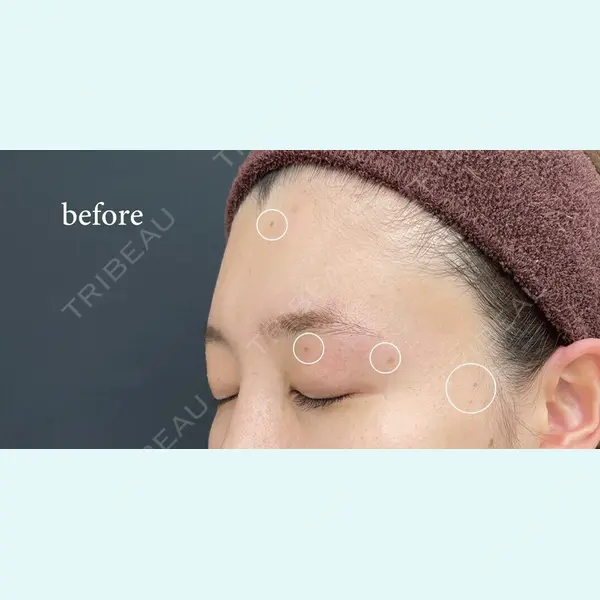 CHARIS BEAUTY CLINICの症例