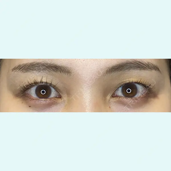 Wi Clinic（ウィ クリニック） 吉祥寺院の症例