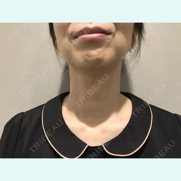 Alohaさおり自由が丘クリニック 藤堂紗織医師の症例