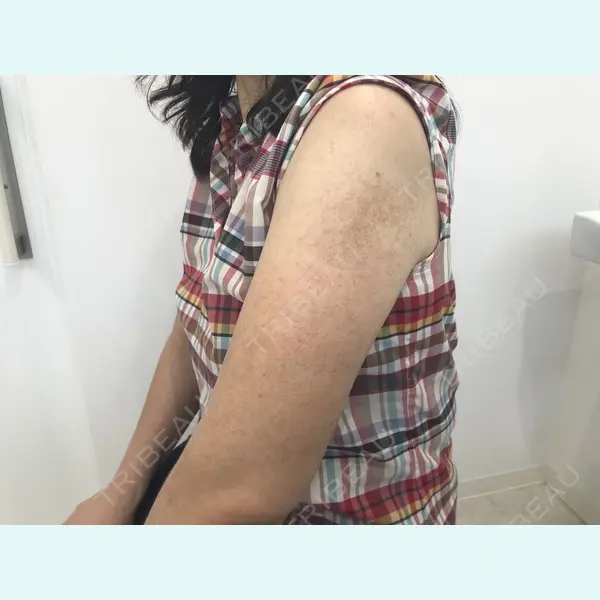 Alohaさおり自由が丘クリニック 藤堂紗織医師の症例