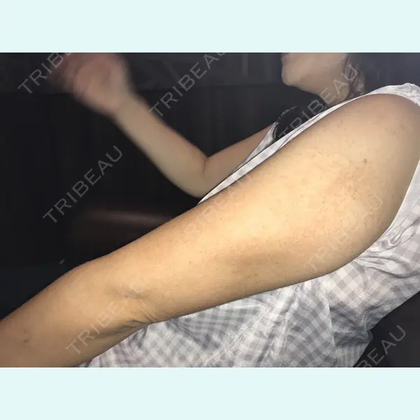 Alohaさおり自由が丘クリニック 藤堂紗織医師の症例